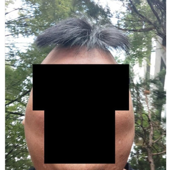 머리카락을 자른건지 머리를 자른건지 ㅋㅋ